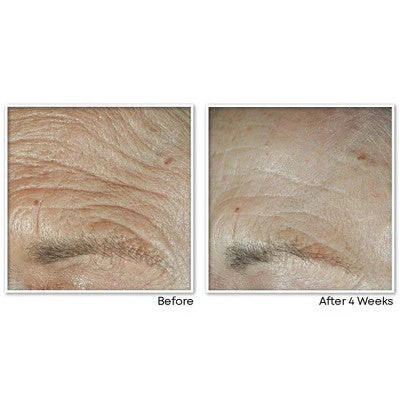 RoC Face & Neck Anti-Aging Moisturizer Firming Cream for Crepey Skin - Image 6